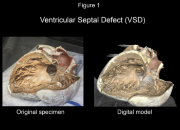 High Resolution Structured Light Scanning for Digital Preservation of Cardiac Pathology Specimens